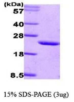 SDS-PAGE: Recombinant Human CIB1 His Protein [NBC1-18394]