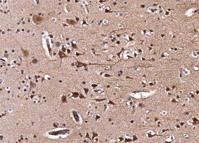 Immunohistochemistry-Paraffin: CIB2 Antibody (001) [NBP2-90129]