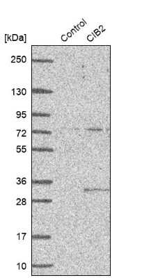 Western Blot: CIB2 Antibody [NBP1-81351]