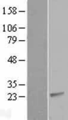 Western Blot: CIB2 Overexpression Lysate [NBL1-09205]