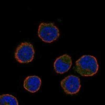 Immunocytochemistry/ Immunofluorescence: CIB3 Antibody [NBP3-17480]