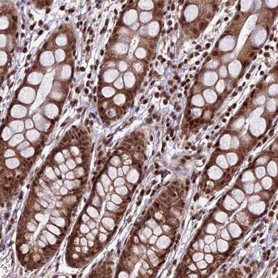 Immunohistochemistry-Paraffin: CIB3 Antibody [NBP1-91786]