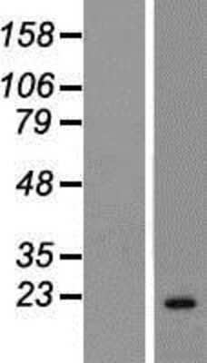 Western Blot: CIB3 Overexpression Lysate [NBP2-05811]