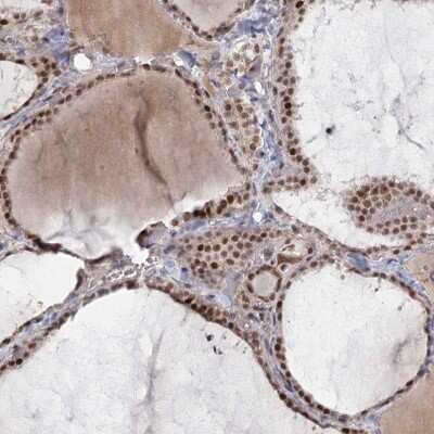 Immunohistochemistry: CIB4 Antibody [NBP2-32717]