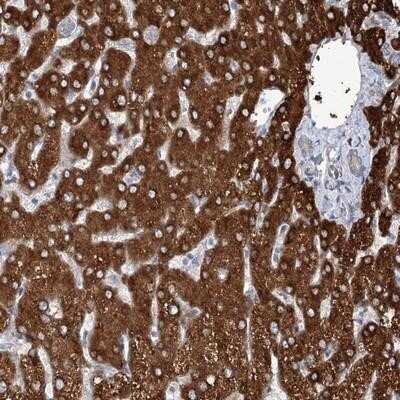 Immunohistochemistry-Paraffin: CIB4 Antibody [NBP1-86293]