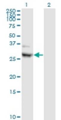 Western Blot: CIDEA Antibody (4B9) [H00001149-M01]