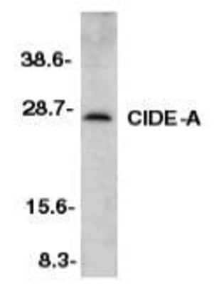 Western Blot: CIDEA AntibodyBSA Free [NBP1-76950]