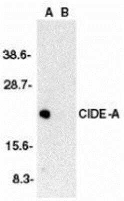 Western Blot: CIDEA AntibodyBSA Free [NBP1-76951]