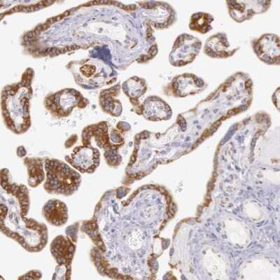 Immunohistochemistry-Paraffin: CIDEB Antibody [NBP2-48489]