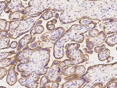 Immunohistochemistry-Paraffin: CIDEB Antibody [NBP2-97721]