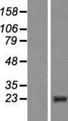 Western Blot: CIDEB Overexpression Lysate [NBP2-07338]