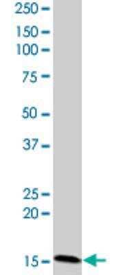 Western Blot: CIDEC Antibody (2E2) [H00063924-M07]