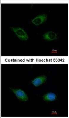 Immunocytochemistry/ Immunofluorescence: CIDEC Antibody [NBP2-15902]