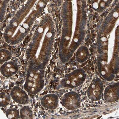 Immunohistochemistry-Paraffin: CIDEC Antibody [NBP1-84469]