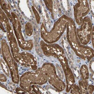 Immunohistochemistry-Paraffin: CIDEC Antibody [NBP1-84470]