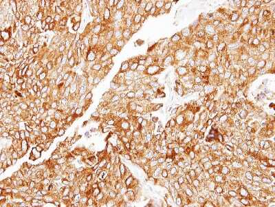 Immunohistochemistry-Paraffin: CIDEC Antibody [NBP2-15902]