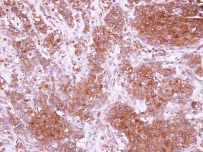 Immunohistochemistry-Paraffin: CIDEC Antibody [NBP2-15903]