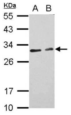 Western Blot: CIDEC Antibody [NBP2-15903]