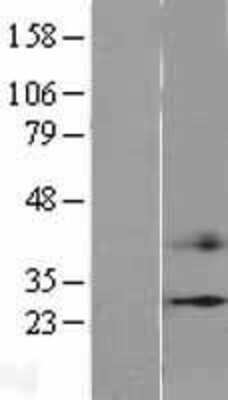 Western Blot: CIDEC Overexpression Lysate [NBL1-09207]