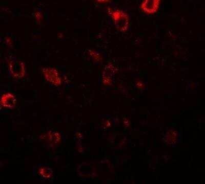 Immunocytochemistry/ Immunofluorescence: CIITA Antibody - BSA Free [NBP2-59072]