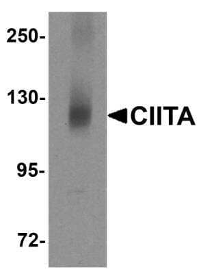 Western Blot: CIITA AntibodyBSA Free [NBP2-59072]