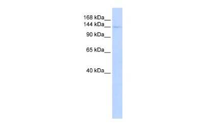 Western Blot: CIITA Antibody [NBP3-10468]