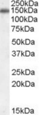 Western Blot: CILP-1 Antibody [NB100-41106]