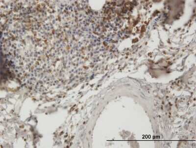 Immunohistochemistry-Paraffin: CIN85/SH3KBP1 Antibody [H00030011-B01P]