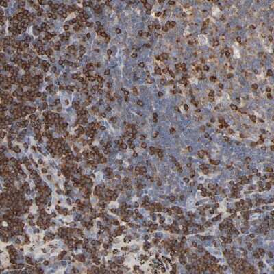 Immunohistochemistry-Paraffin: CIN85/SH3KBP1 Antibody [NBP1-85614]