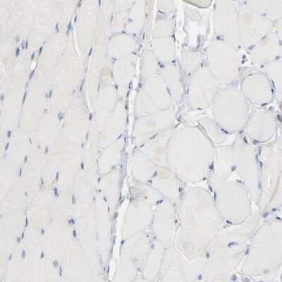Immunohistochemistry-Paraffin: CIN85/SH3KBP1 Antibody [NBP1-85614]