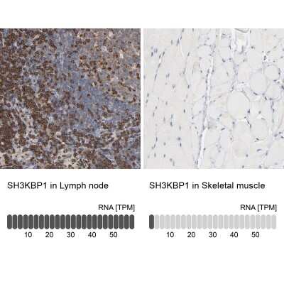 Immunohistochemistry-Paraffin: CIN85/SH3KBP1 Antibody [NBP1-85614]