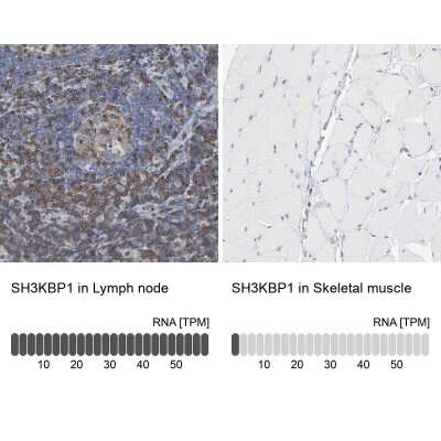 Immunohistochemistry-Paraffin: CIN85/SH3KBP1 Antibody [NBP1-85615]