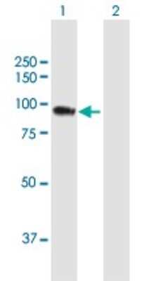 Western Blot: CIN85/SH3KBP1 Antibody [H00030011-B01P]