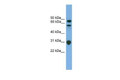 Western Blot: CIN85/SH3KBP1 Antibody [NBP1-57065]