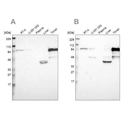 Western Blot: CIN85/SH3KBP1 Antibody [NBP1-85614]