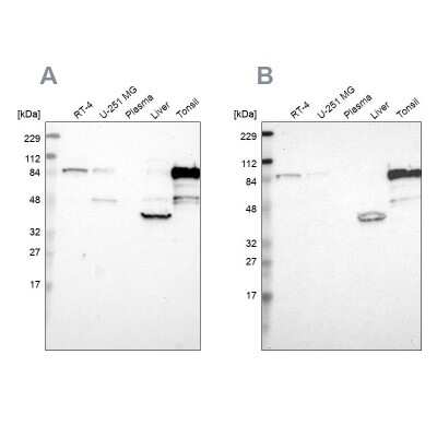 Western Blot: CIN85/SH3KBP1 Antibody [NBP1-85615]