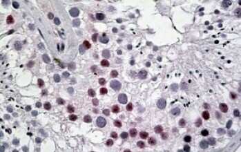 Immunohistochemistry-Paraffin: CINAP Antibody [NBP1-52123]