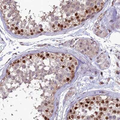 Immunohistochemistry-Paraffin: CINAP Antibody [NBP1-91787]