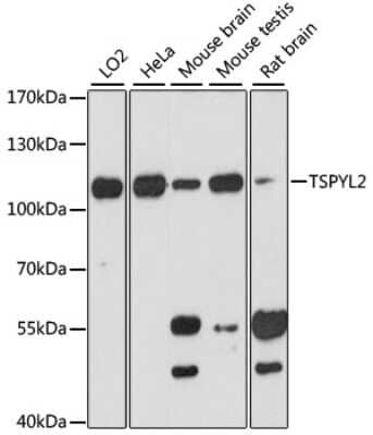 Western Blot: CINAP AntibodyAzide and BSA Free [NBP2-92107]