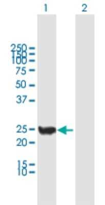 Western Blot: CINP Antibody [H00051550-B01P]