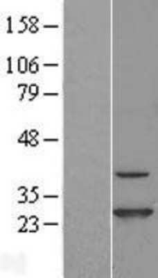 Western Blot: CINP Overexpression Lysate [NBL1-09209]