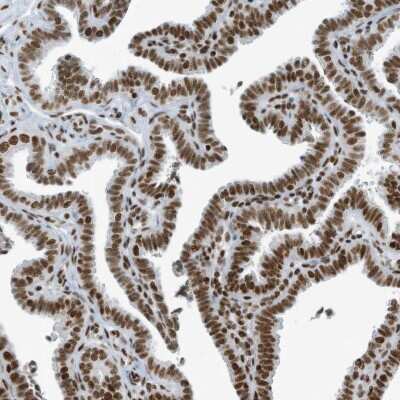 Immunohistochemistry-Paraffin: CIP29 Antibody [NBP1-88084]