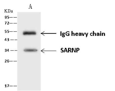 Immunoprecipitation: CIP29 Antibody [NBP2-97653]