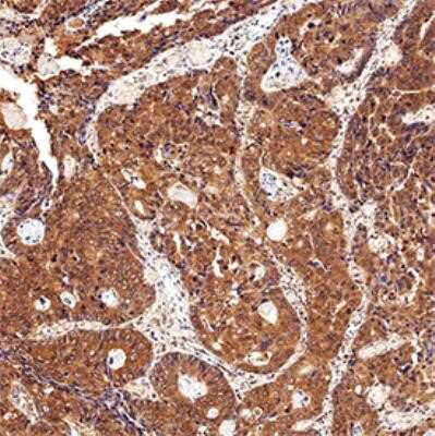 Immunohistochemistry-Paraffin: CIP2A Antibody (2G10) - Azide and BSA Free [NBP2-80670]
