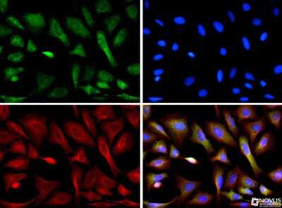 Immunocytochemistry/ Immunofluorescence: CIP2A Antibody (2G10) [NB110-59722]