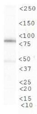 Western Blot: CIP2A Antibody (2G10) [NB110-59722]