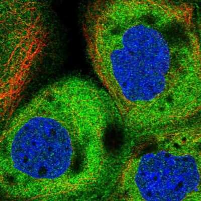 Immunocytochemistry/ Immunofluorescence: CIP2A Antibody [NBP2-48710]