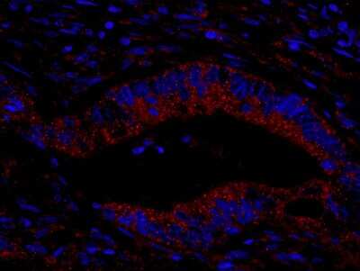 Immunohistochemistry: CIP2A Antibody [NB100-74663]