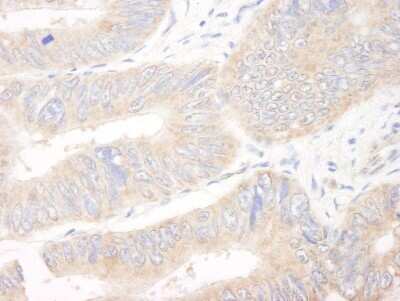 Immunohistochemistry-Paraffin: CIP2A Antibody [NB100-68264]