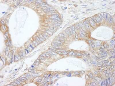 Immunohistochemistry-Paraffin: CIP2A Antibody [NB100-74663]